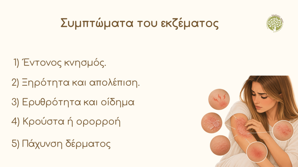 Συμπτώματα του εκζέματος