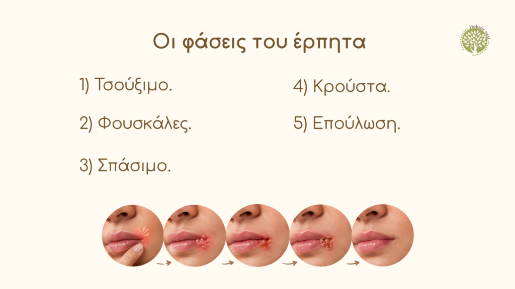 Οι φάσεις του έρπητα